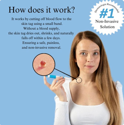 TagBuddy Kit™ - No More Skin Tags
